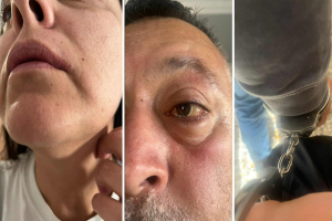 Λέσβος: Καταγγελία από Τούρκους τουρίστες – «Μας πέρασαν χειροπέδες για μερικά πακέτα τσιγάρα»